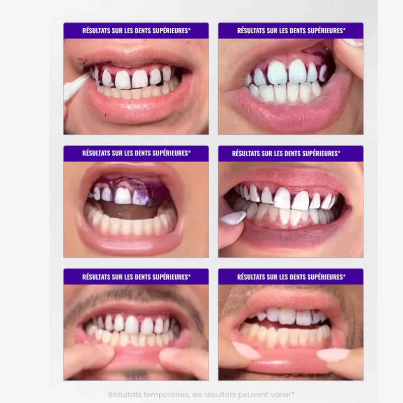 Bande blanchissantes 30 min