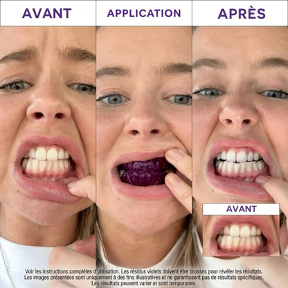 Bande blanchissantes 30 min