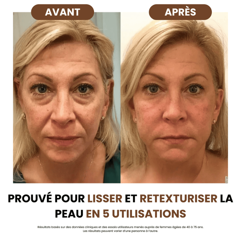 Brosse Drainage Lymphatique sly™