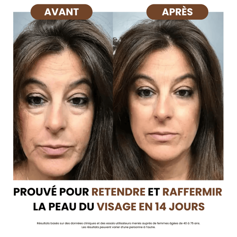 Brosse Drainage Lymphatique sly™