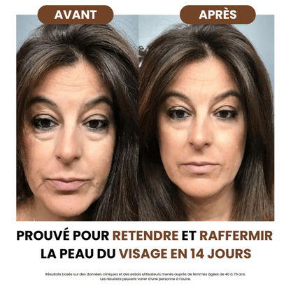 Brosse Drainage Lymphatique sly™